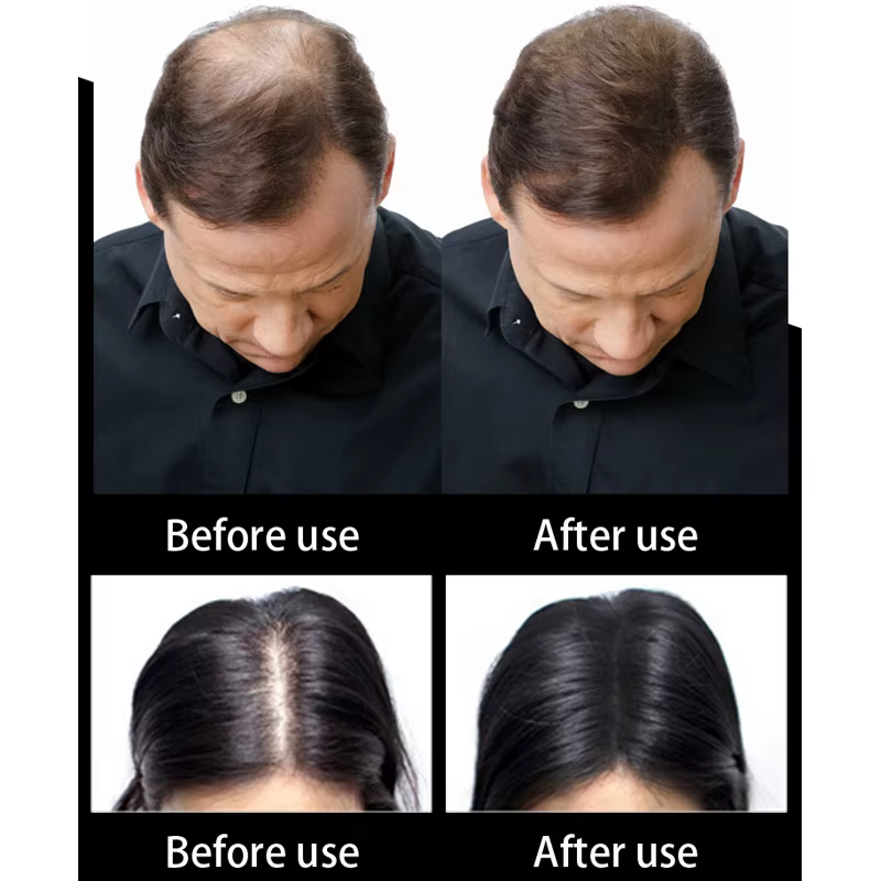 SEVICH – Fiber de cheveux à la kératine, 500g, traitement de perte de cheveux humains, soins de coul
