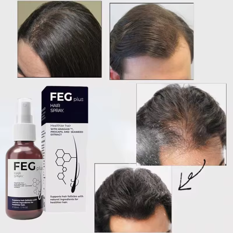 FEG-Huile de Soins Capillaires Biologique, pour Cheveux Longs, pour la Maison, Rotterdam y, 50ml