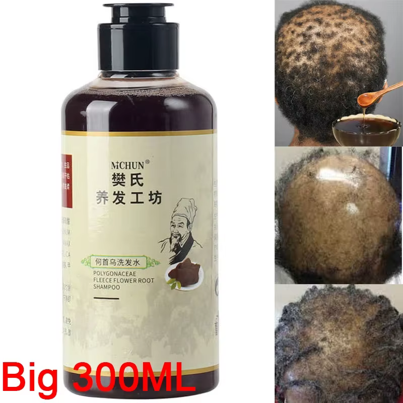 Shampoing Traitant la Chute de Cheveux pour Hommes et Femmes, 300ml, Spécial Afrique, Contre l'Alopé