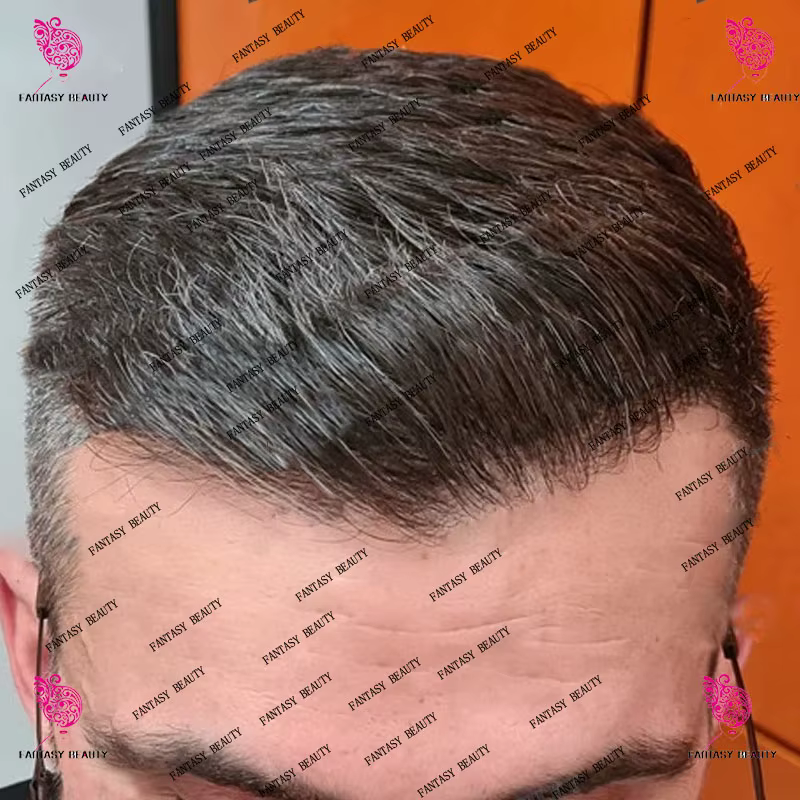 Perruque toupet pour hommes, naissance des cheveux naturelle, 30mm, ondulée/droite naturelle, Durabl