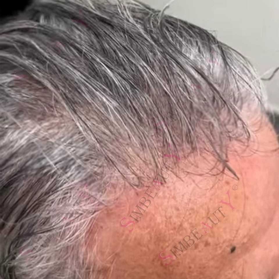 Lumière 80% densité 0.02mm Utral peau mince ligne de cheveux Invisible blanc argent gris noir 1B65 1
