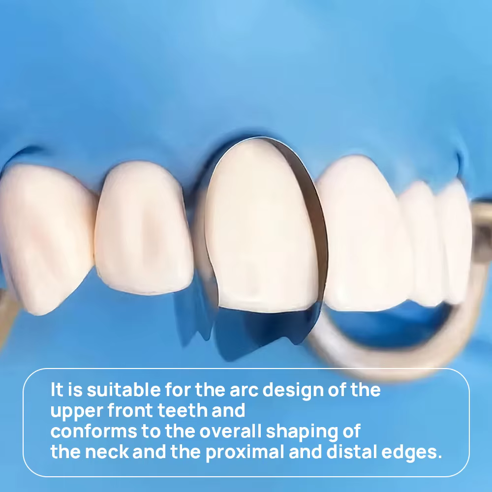 30 pièces matrice dentaire profilée bandes de matrice métallique antérieure système de matrice sectionnelle Matrices matériaux de dentisterie