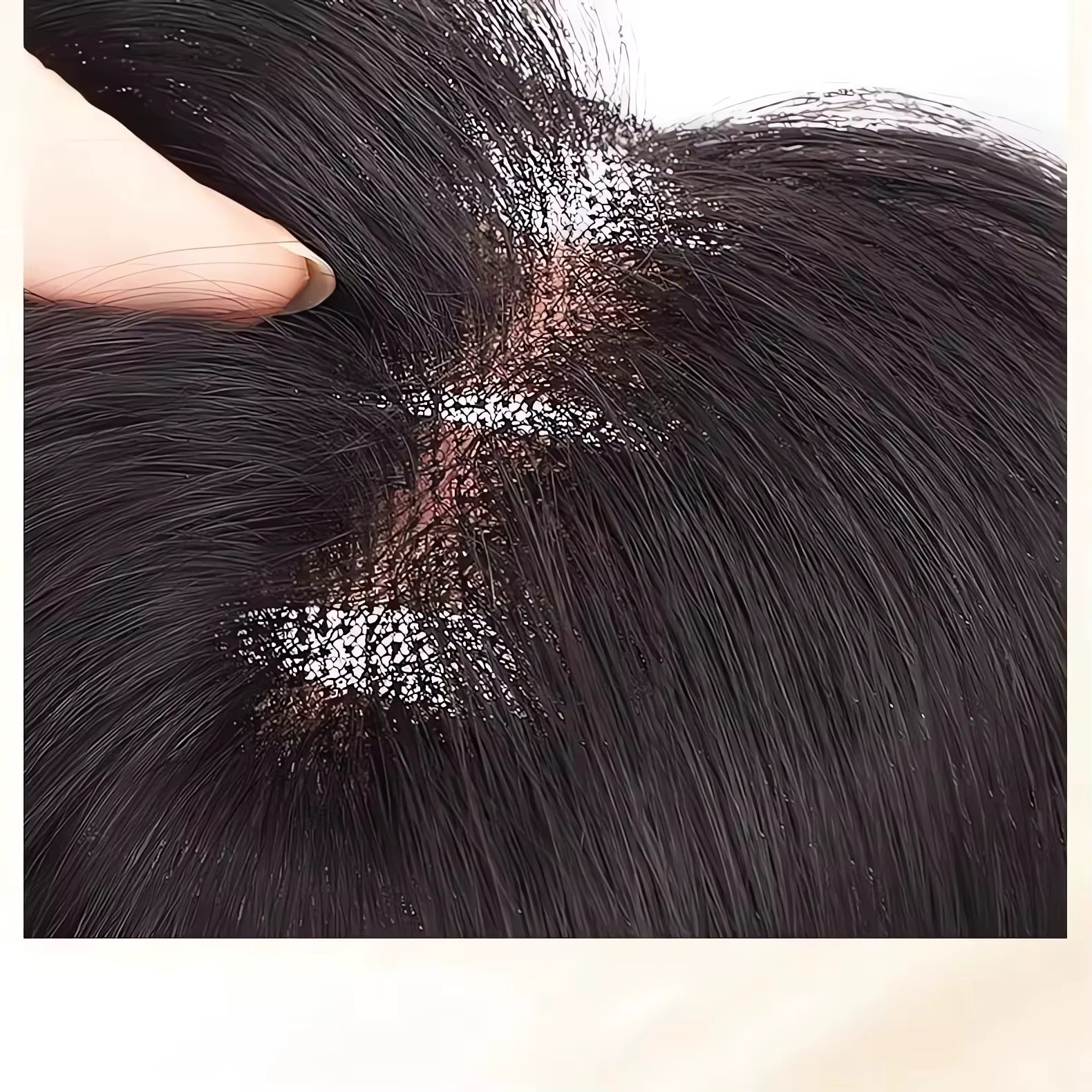 Perruque femme Figure-huit frange ajouter du Volume à la haut de la tête