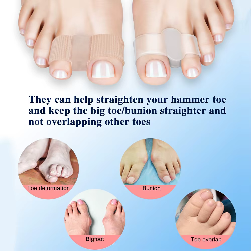 Séparateur d'orteils, correcteur d'oignon Hallux Valgus, orthèses, ajusteur de pouce, pédicure, lisseur de pieds, 2 paires