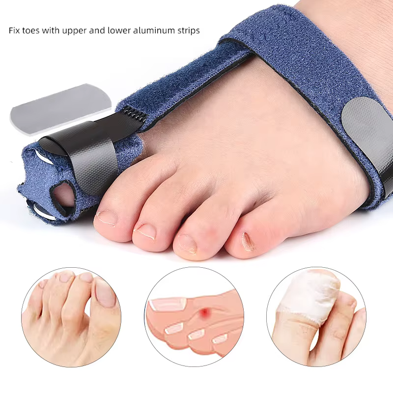 Correcteur d'orteils, fixateur de Fracture d'orteils, orthèses, os du pied, ajusteur de pouce, chaussettes de pédicure douces, redresseur d'oignon