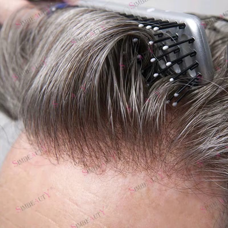 Prothèse capillaire invisible et confortable pour hommes