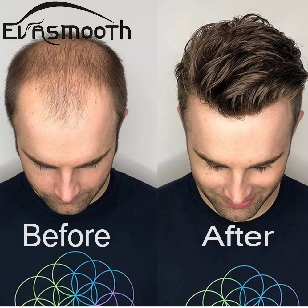 Prothèse capillaire pour hommes