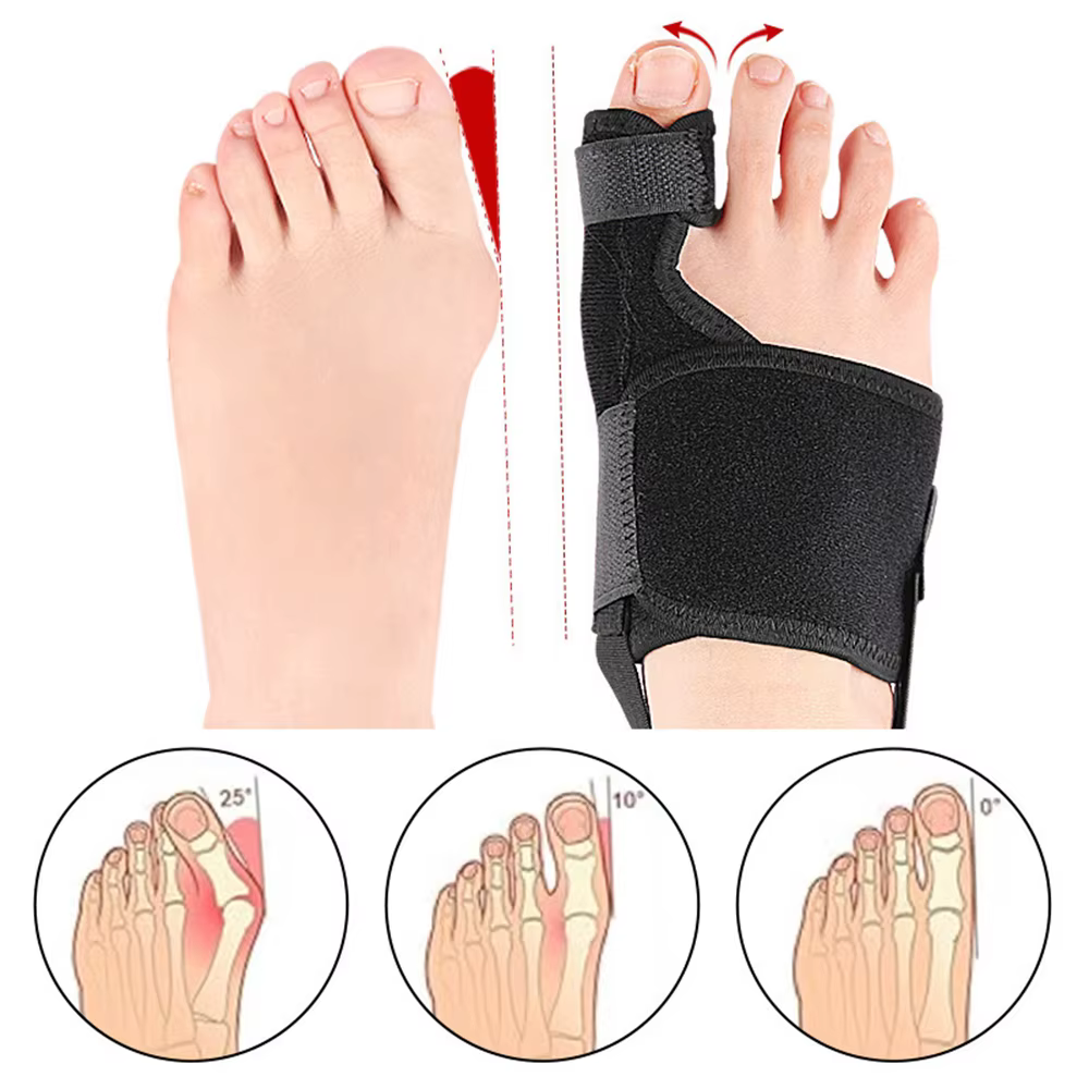 Correcteur d'orteils orthopédique, ajusteur d'orteil en biseau, protecteur de marteau phalangeal, correcteur de hallux valgus, outil orthopédique, outils de soin